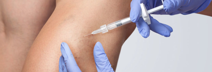 Traiter les varices